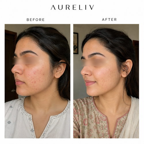 Dark Spots Reduced – 4 Weeks