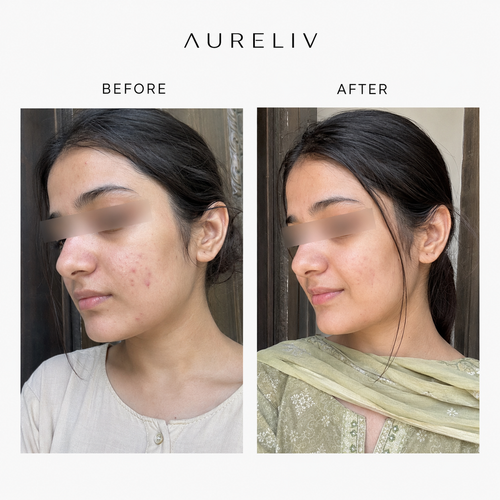 Visible Brightening – 21 Days